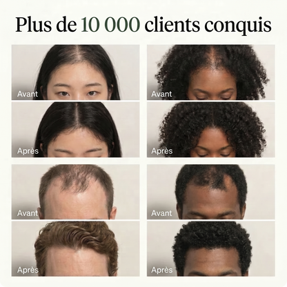 Barre Coréenne Cuir Chevelu
